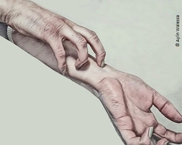 Neurodermitis führt zu einem Juck-Kratz-Kreislauf