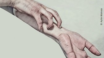 Blogübersicht - „Nicht kratzen!“ – Mein Juckreiz und wie andere ihn wahrnehmen